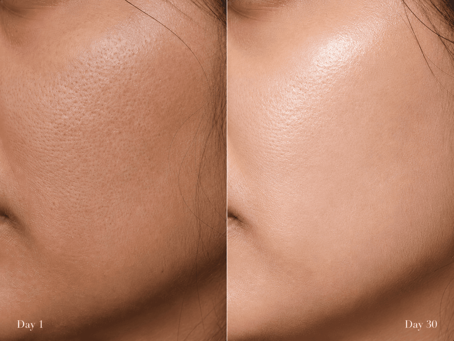 Close view of skin, shown from the start of a month to the end of a month